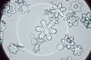 © Neuschnee GmbH/ Schneekristalle unter dem Mikroskop